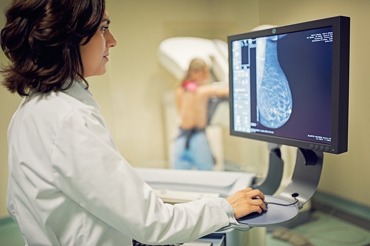 Mammography in Breast Cancer: Background, X-ray Mammography, Ultrasound
